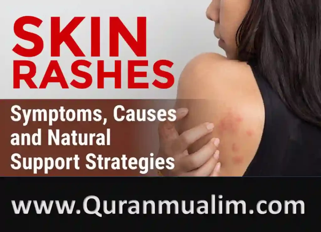 rash in eyebrows,rash on side of stomach,how to get rid of a face rash,medications for rashes,
rash on back of neck at hairline,rash behind ears,ointment for skin rash,i have a rash on my neck,
infections that cause rashes,burning red rash,red rash on top of hand,bumpy rash on ears,rash lotion
