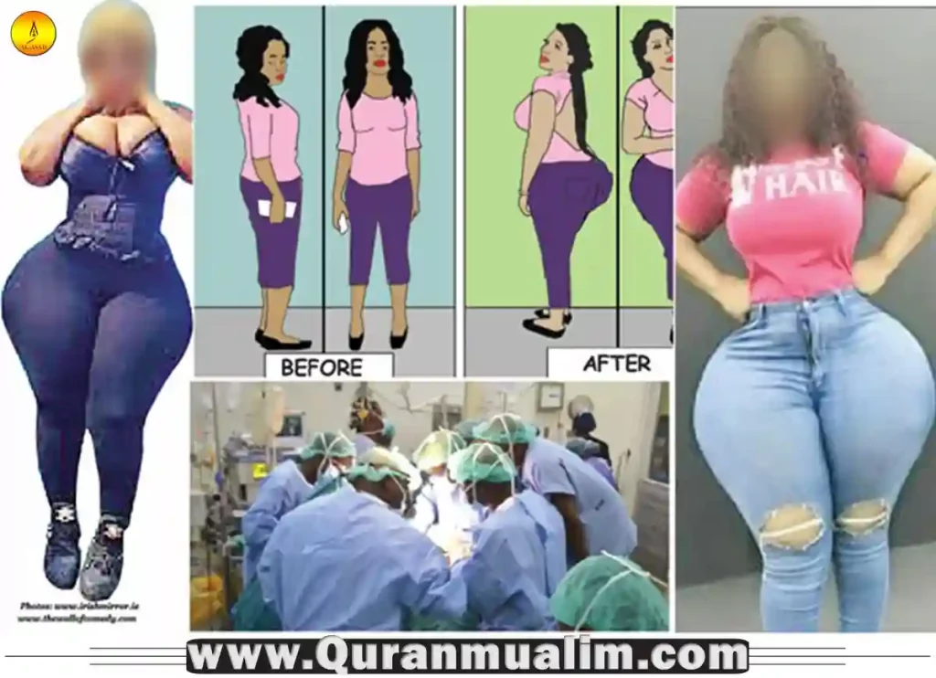 is liposuction haram, is it haram to get liposuction, is liposuction haram in islam, is liposuction haram, fat muslim ,is being fat haram, is it haram to be fat
