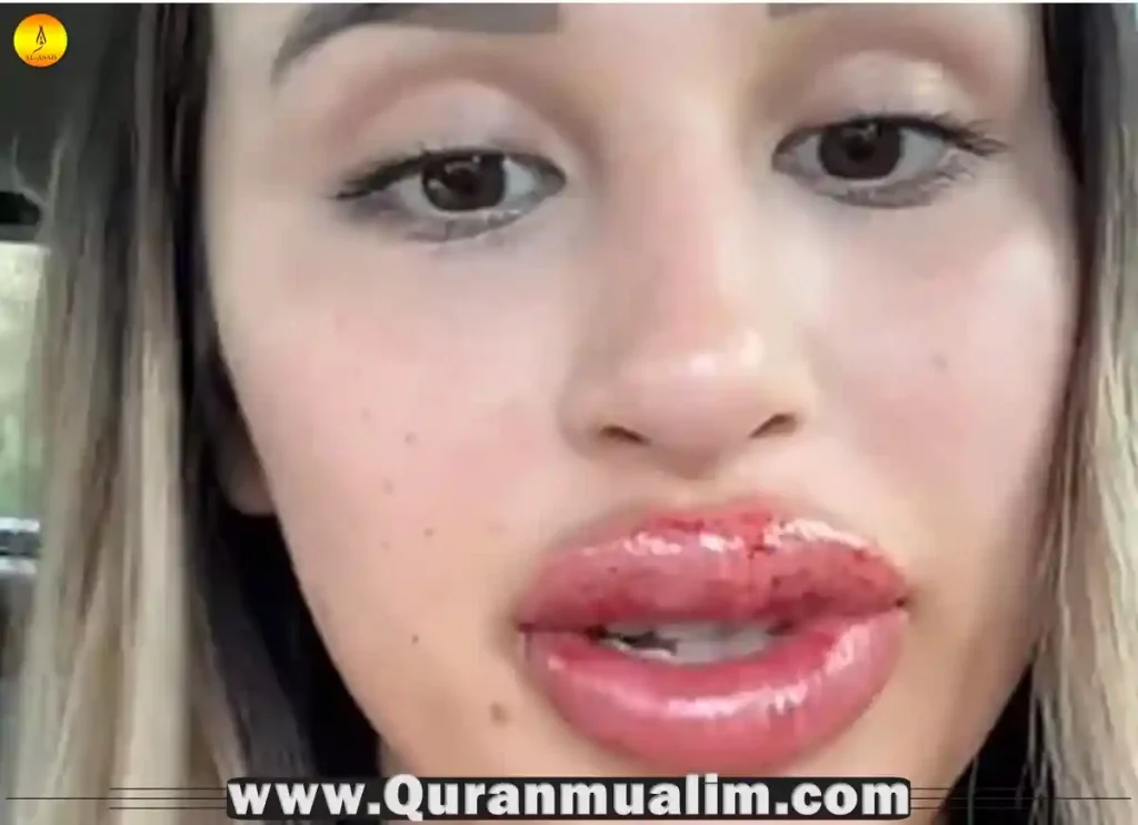 lip blushing gone wrong, lip blush gone wrong, lip blush gone wrong reddit, lip blush tattoo gone wrong, lip blush fade ,lip blush touch up healing, bad lip blushing, lip blushing day by day, lip blush peeling, lip blushing peeling