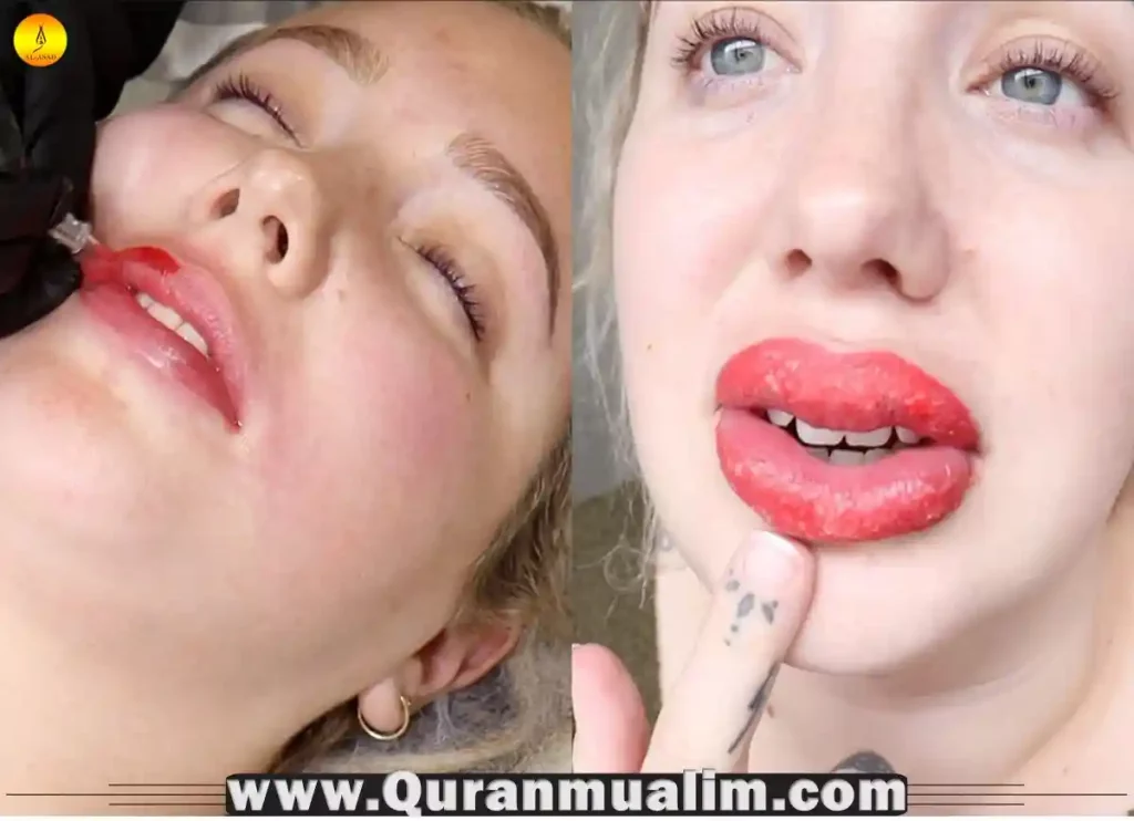 lip blushing gone wrong, lip blush gone wrong, lip blush gone wrong reddit, lip blush tattoo gone wrong